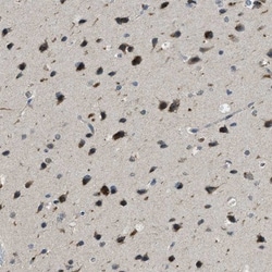 Importin-7 Antibody, Novus Biologicals:Antibodies:Primary Antibodies