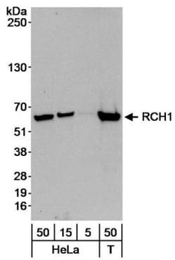 Importin alpha 2/KPNA2 Antibody, Novus Biologicals 0.1mL; Unlabeled:Antibodies,