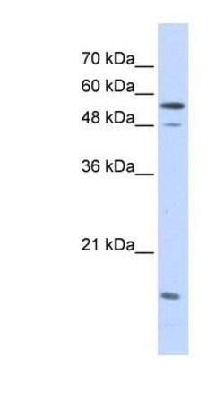 Importin alpha 2/KPNA2 Antibody, Novus Biologicals 100&mu;L; Unlabeled:Antibodies,