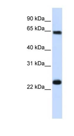 Importin alpha 5/KPNA1/SRP1 Antibody, Novus Biologicals:Antibodies:Primary