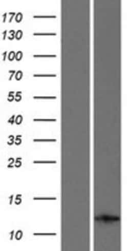 Novus Biologicals&trade;&nbsp;INCA Overexpression Lysate