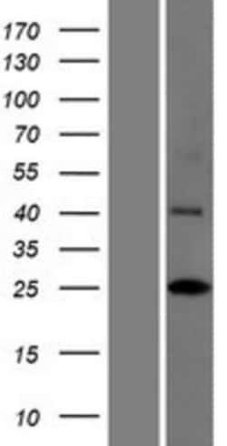 Novus Biologicals&trade;&nbsp;INCA1 Overexpression Lysate