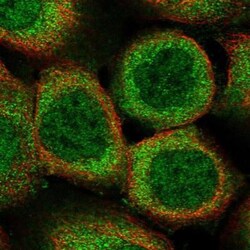 INCA1 Antibody, Novus Biologicals 0.1mL; Unlabeled:Antibodies, Polyclonal