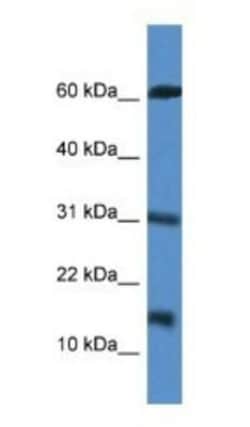 INCA Antibody, Novus Biologicals 100&mu;L; Unlabeled:Antibodies, Polyclonal
