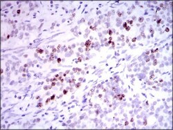 INCENP Antibody (3D2) - BSA Free, Novus Biologicals 0.025 mL, Unlabeled:Antibodies,