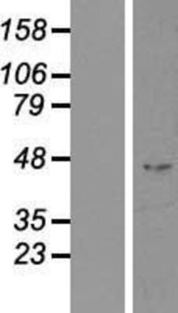 Novus Biologicals&trade;&nbsp;Indian Hedgehog/Ihh Overexpression Lysate