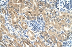Indian Hedgehog/Ihh Antibody, Novus Biologicals 0.1mg; Unlabeled:Antibodies,