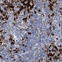 Indoleamine 2,3-dioxygenase/IDO Antibody, Novus Biologicals:Antibodies:Primary