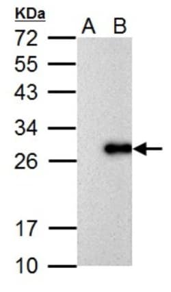 Influenza A H1N1 M1 Antibody - (A/Puerto Rico/8/1934), Novus Biologicals 0.1 mL | Buy Online | Novus Biologicals | Fisher Scientific