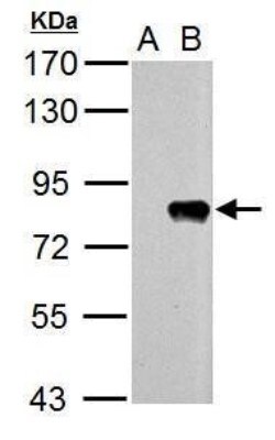 Influenza A H1N1 PB2 Antibody, Novus Biologicals 0.1mL:Antibodies, Polyclonal