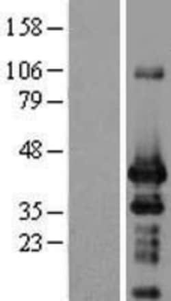 Novus Biologicals&trade;&nbsp;ING1 Overexpression Lysate