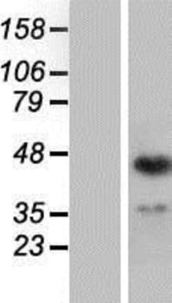 Novus Biologicals&trade;&nbsp;ING1 Overexpression Lysate