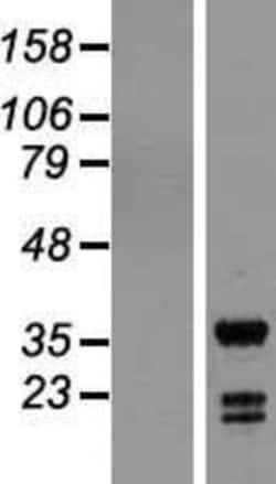 Novus Biologicals&trade;&nbsp;ING5 Overexpression Lysate