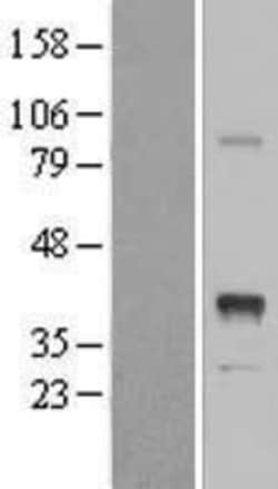 Novus Biologicals™ INHBE Overexpression Lysate