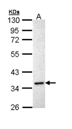 Inhibin alpha Antibody, Novus Biologicals 0.1mL; Unlabeled:Antibodies,