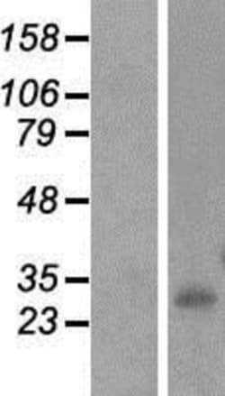 Novus Biologicals&trade;&nbsp;INMT Overexpression Lysate