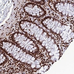 INO80E Antibody, Novus Biologicals:Antibodies:Primary Antibodies