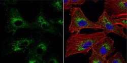 iNOS Antibody, Novus Biologicals 0.1mL:Antibodies, Polyclonal