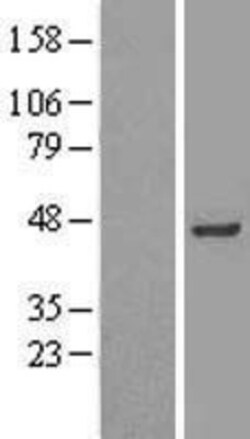 Novus Biologicals&trade;&nbsp;INPP1 Overexpression Lysate