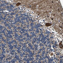 INPP5A Antibody, Novus Biologicals 0.1mL; Unlabeled:Antibodies, Polyclonal