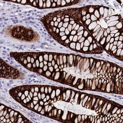 INSC Antibody, Novus Biologicals 25 &mu;L; Unlabeled:Antibodies, Polyclonal