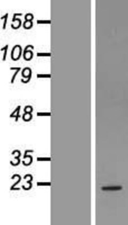 Novus Biologicals&trade;&nbsp;INSIG-1 Overexpression Lysate