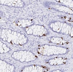 CrkRS Antibody, Novus Biologicals:Antibodies:Primary Antibodies