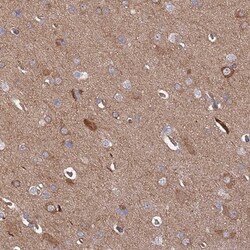 INSM2 Antibody, Novus Biologicals:Antibodies:Primary Antibodies