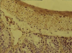 Integrin alpha 5 beta 1 Antibody (BMC5), Novus Biologicals:Antibodies:Primary