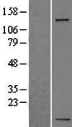 Novus Biologicals&trade;&nbsp;Integrin alpha 5/CD49e Overexpression Lysate