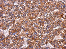 Integrin alpha 9 Antibody, Novus Biologicals 0.1mL; Unlabeled:Antibodies,