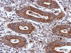 Integrin beta 1/CD29 Antibody, Novus Biologicals 0.1mL; Unlabeled:Antibodies,