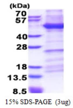 Novus Biologicals&trade;&nbsp;Recombinant Human Integrin beta 1D His Protein