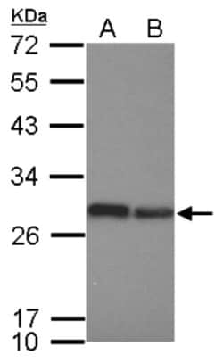 integrin beta 4 binding protein Antibody, Novus Biologicals 0.1mL; Unlabeled:Antibodies,