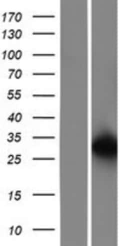 Novus Biologicals&trade;&nbsp;integrin beta 4 binding protein Overexpression Lysate