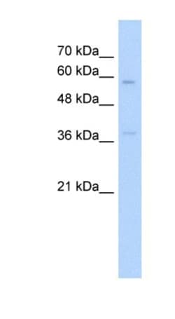 Integrin beta-like protein 1 Antibody, Novus Biologicals 100 &mu;L; Unconjugated:Antibodies,