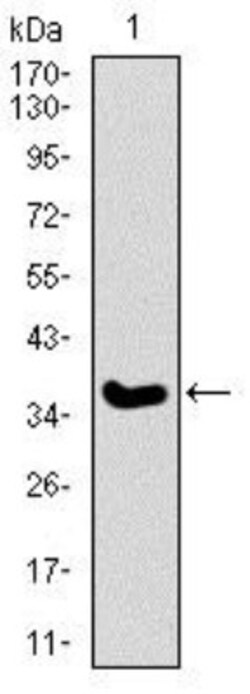 Integrin alpha 2b/CD41 Antibody (2E10C9) - BSA Free, Novus Biologicals:Antibodies:Primary