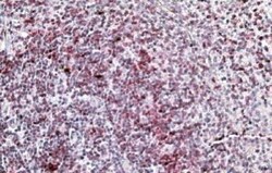 Integrin alpha L/CD11a Antibody, Novus Biologicals 0.1mg; Unlabeled:Antibodies,