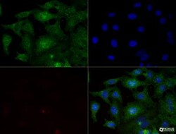 Integrin beta 1/CD29 Antibody (P4C10) - BSA Free, Novus Biologicals:Antibodies:Primary