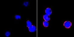 Integrin beta 2/CD18 Antibody (10E12), Novus Biologicals 0.1mL; Unlabeled:Antibodies,