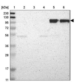 Integrin beta 2/CD18 Antibody, Novus Biologicals 0.1mL; Unlabeled:Antibodies,