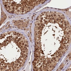 integrin beta 4 binding protein Antibody, Novus Biologicals 0.1mL; Unlabeled:Antibodies,