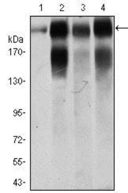 Integrin beta 4/CD104 Antibody (10B10D5), Novus Biologicals:Antibodies:Primary