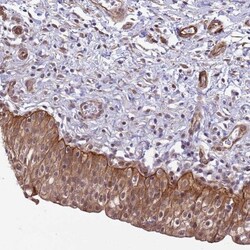 Integrin beta 4/CD104 Antibody, Novus Biologicals:Antibodies:Primary Antibodies