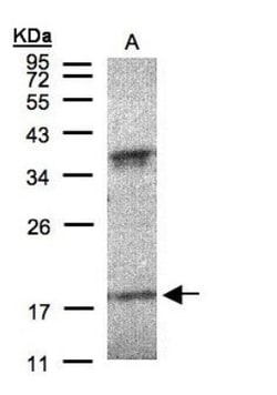 IFN-alpha K Antibody, Novus Biologicals 0.1mg; Unlabeled:Antibodies, Polyclonal