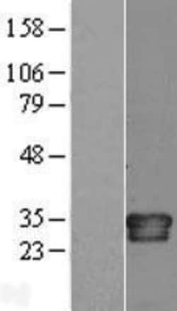 Novus Biologicals&trade;&nbsp;IL-34 Overexpression Lysate