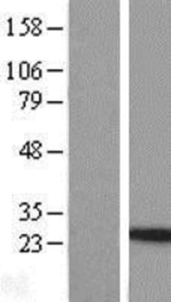Novus Biologicals&trade;&nbsp;IL-24 Overexpression Lysate