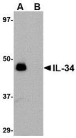 Novus Biologicals&trade;&nbsp;IL-34 Antibody Blocking Peptide
