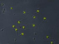 p97/VCP Antibody (Hs-14), Novus Biologicals 0.1mg; Unlabeled:Antibodies,
