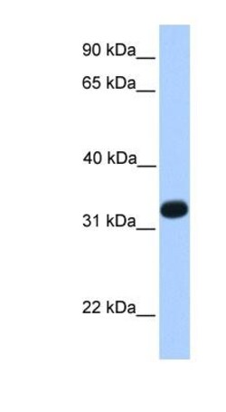 Intra Acrosomal Protein Antibody, Novus Biologicals 100μL; Unlabeled:Antibodies,